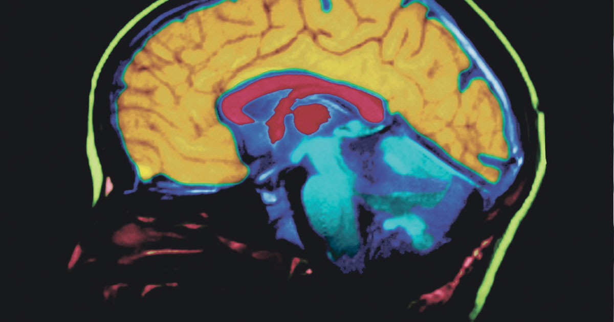 The Brain and Body Connection — Info from the Alzheimer’s Association The Brain and Body Connection — Info from the Alzheimer’s Association
