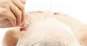 Ease Pain with Acupuncture Treatments — Medicare Covers at Least 12 Sessions Senior woman getting acupuncture, to represent how acupuncture treatments help with pain