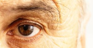 closeup photo of an elderly man's eye for an article about eye disease